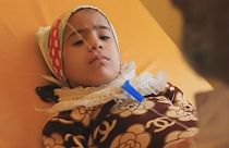 شیوع وبا و دیفتری در یمن؛ سازمان ملل خواستار توقف حملات شد