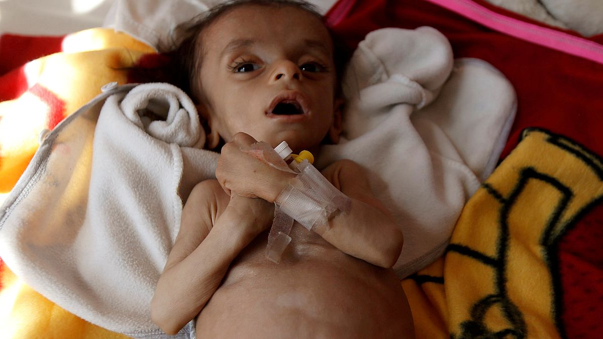 أكثر من 8 ملايين يمني على حافة المجاعة
