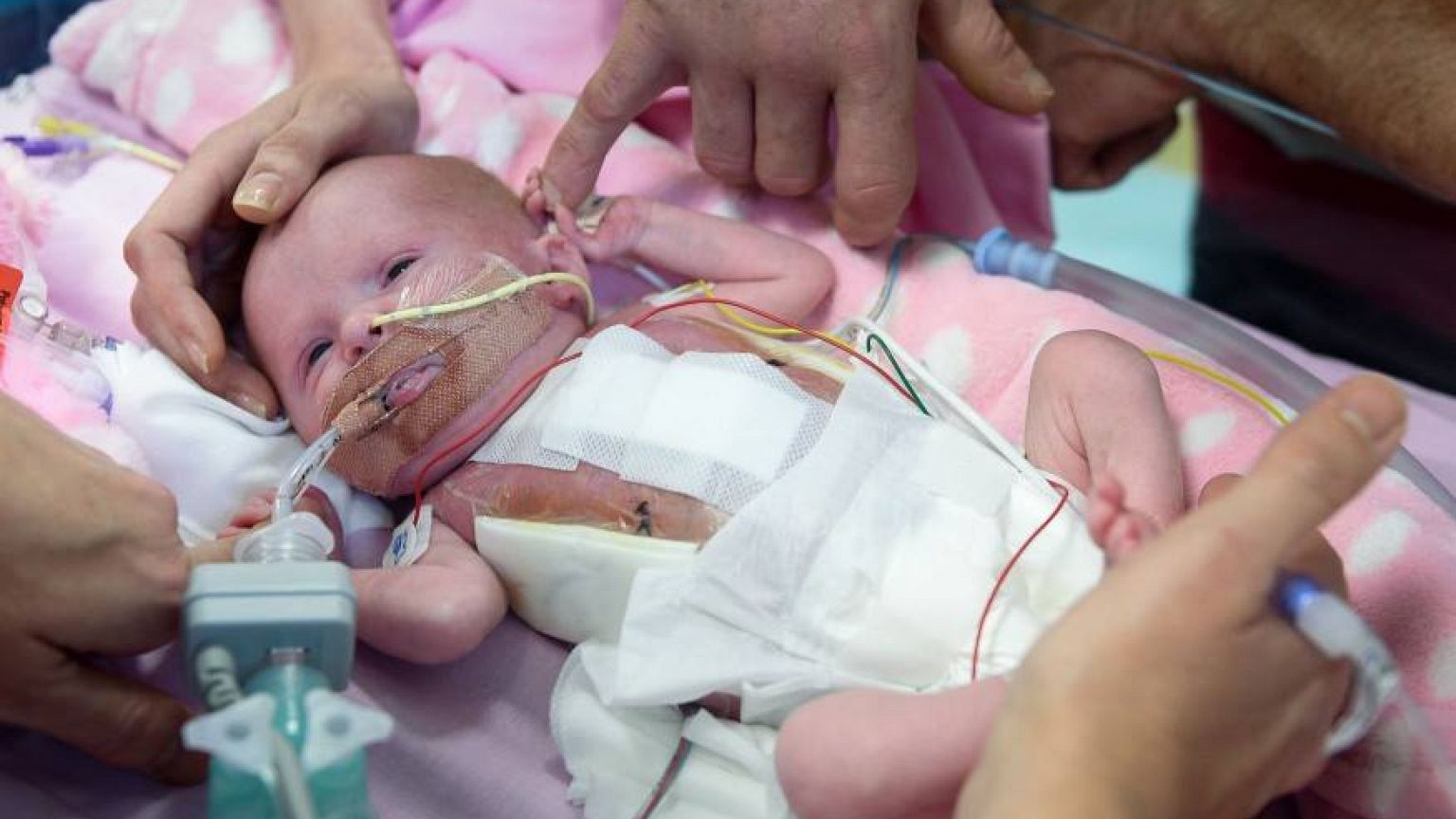 Foto: Leicester's Hospital Facebook