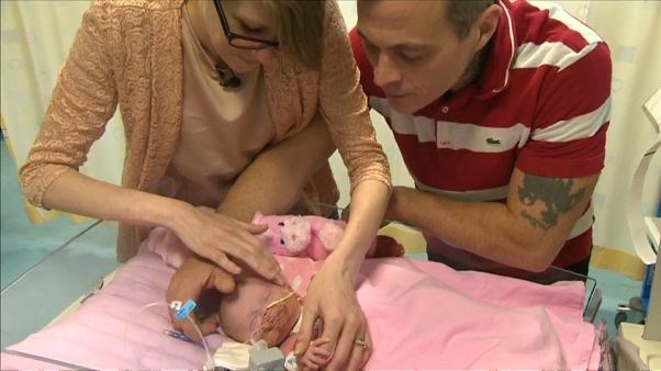 Sauvée après être née avec un coeur hors du corps Sauvée après être née avec un coeur hors du corps