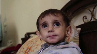 Crianças morrem de fome na Síria