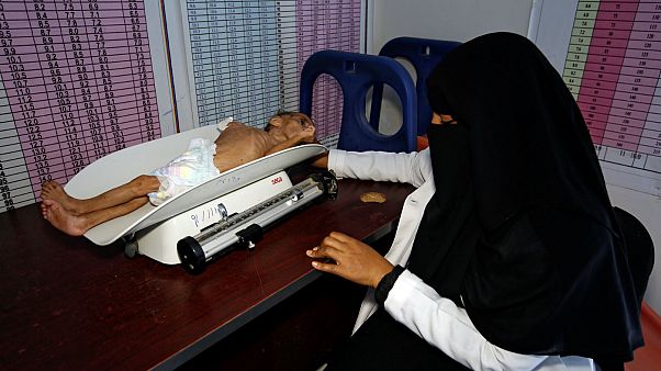 a malnutrition treatment center in the Red Sea port city of Hodeida a malnutrition treatment center in the Red Sea port city of Hodeida