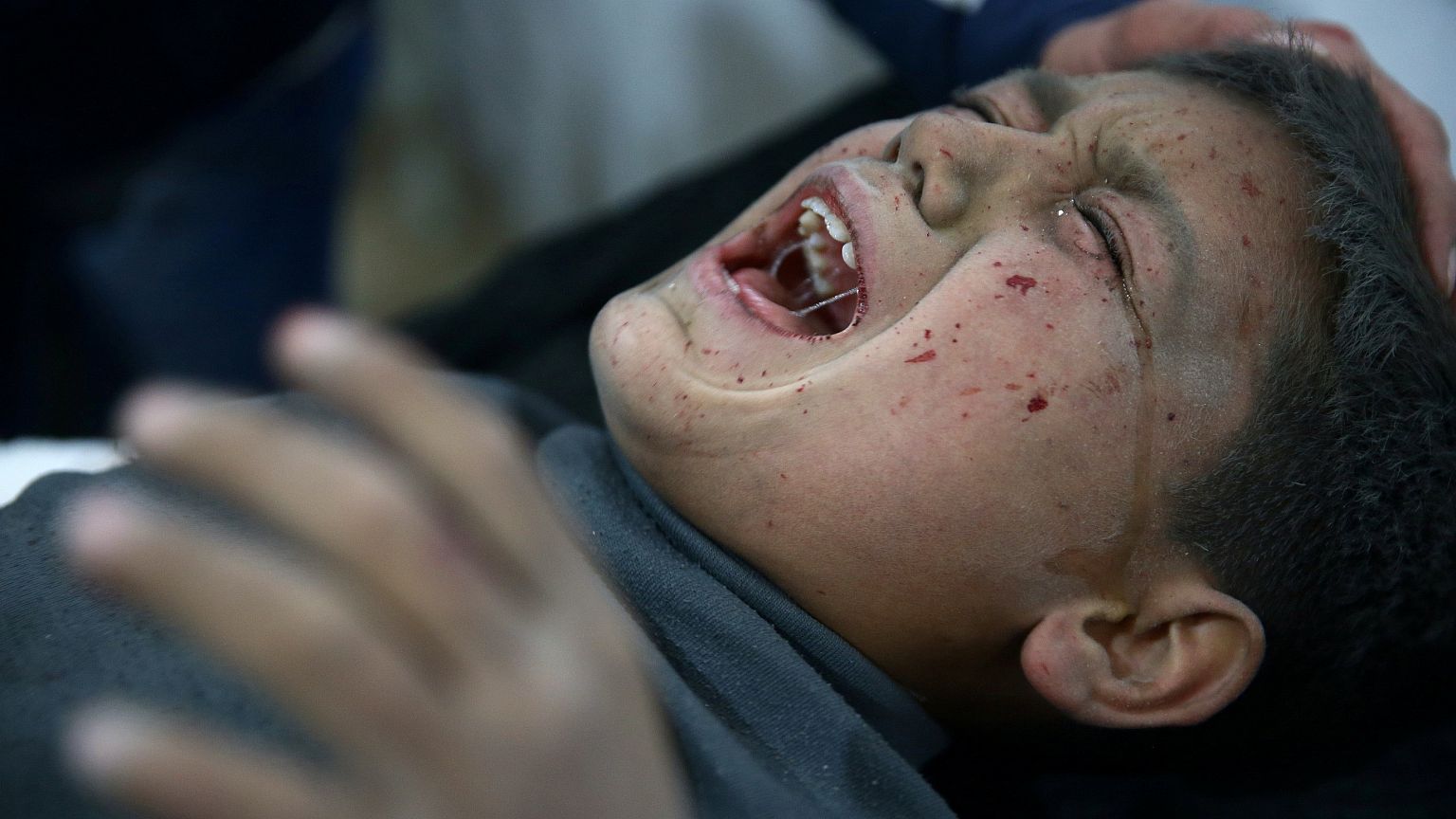 Verletzer Junge in Ghouta in Syrien