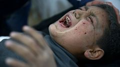 Verletzer Junge in Ghouta in Syrien