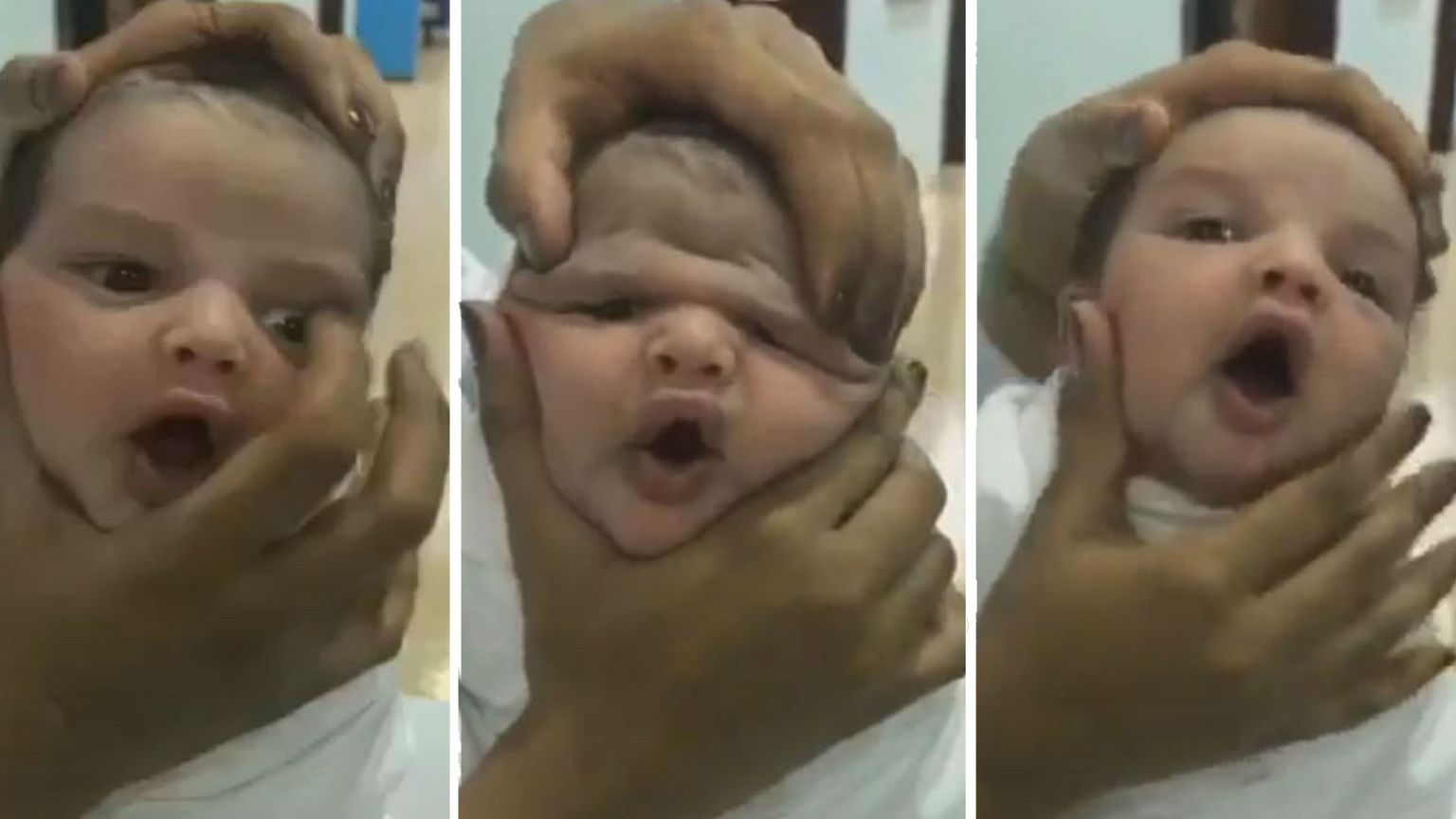 ممرضات يعبثن بوجه رضيع في الطائف