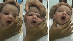 ممرضات يعبثن بوجه رضيع في الطائف