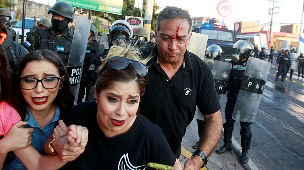 Mais de 20 feridos em confrontos nas Honduras Mais de 20 feridos em confrontos nas Honduras