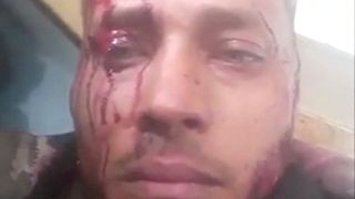 Venezuelas Militär greift Aufständische an - Mehrere Tote