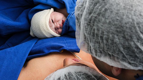 In Deutschland kommen rund 30 Prozent der Kinder per Kaiserschnitt zur Welt In Deutschland kommen rund 30 Prozent der Kinder per Kaiserschnitt zur Welt