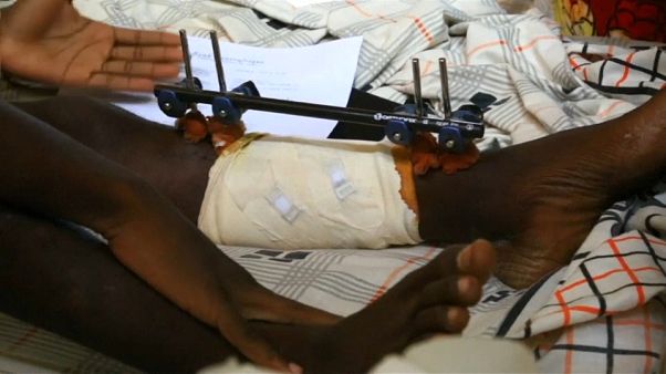 Le Ong lanciano l'allarme: grave crisi umanitaria in Centrafrica Le Ong lanciano l'allarme: grave crisi umanitaria in Centrafrica