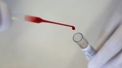 Áttörés jöhet a rák diagnosztizálásában