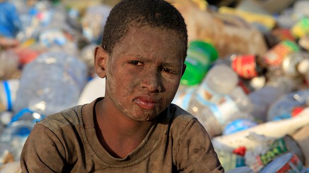Yemen'deki ölümlerin asıl sebebi açlık ve salgın hastalık Yemen'deki ölümlerin asıl sebebi açlık ve salgın hastalık