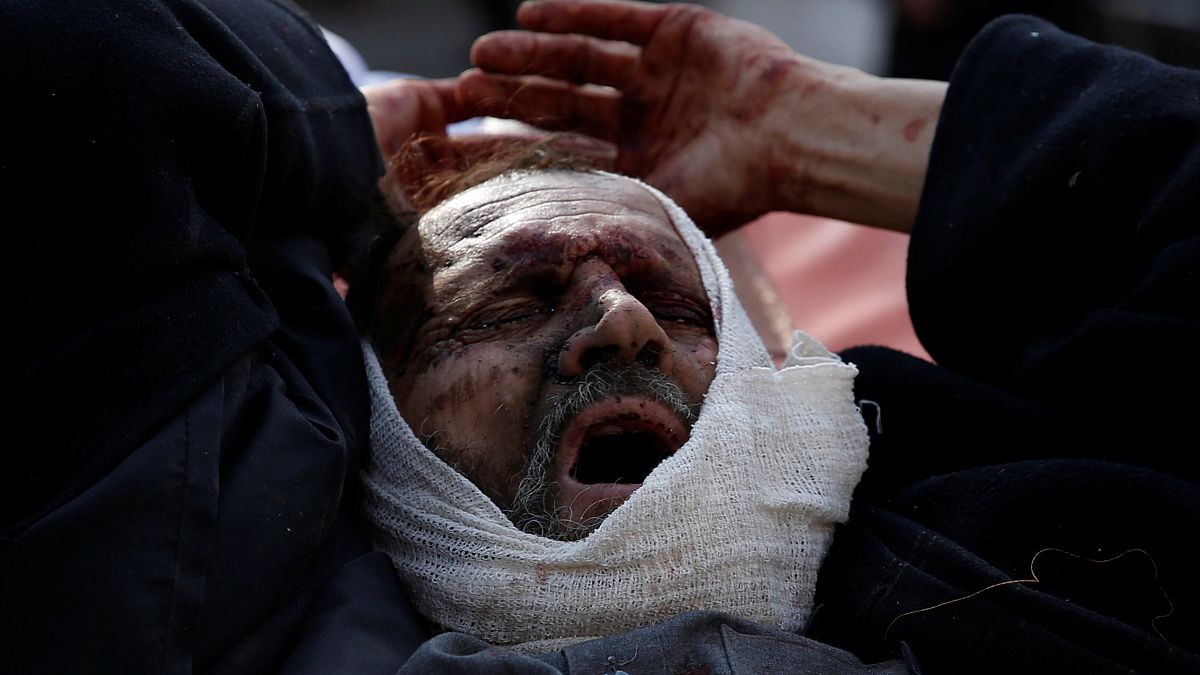 Masacre en Kabul: cerca de 100 muertos