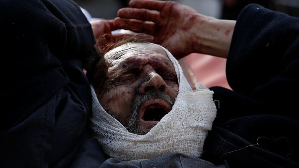 Masacre en Kabul: cerca de 100 muertos Masacre en Kabul: cerca de 100 muertos