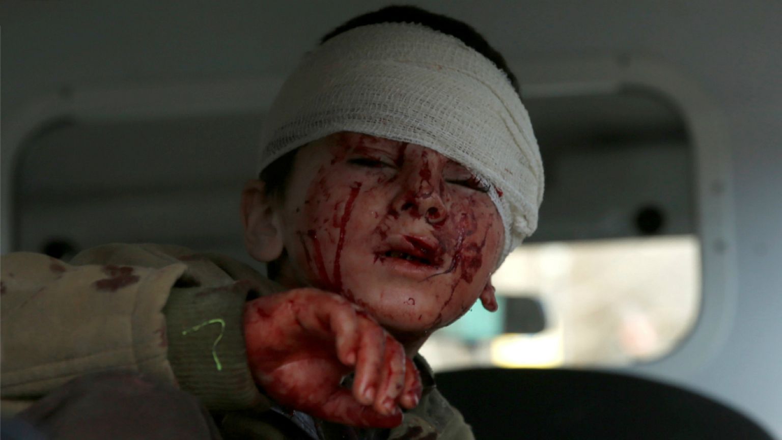 Kabul attack