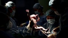 Un médecin tient un nouveau-né pendant qu'un autre coupe le cordon