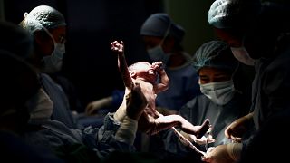 Un médecin tient un nouveau-né pendant qu'un autre coupe le cordon