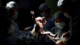Gewalt in der Geburtshilfe: Ärzte sehen die Frau als "Gebärmutter auf Beinen"