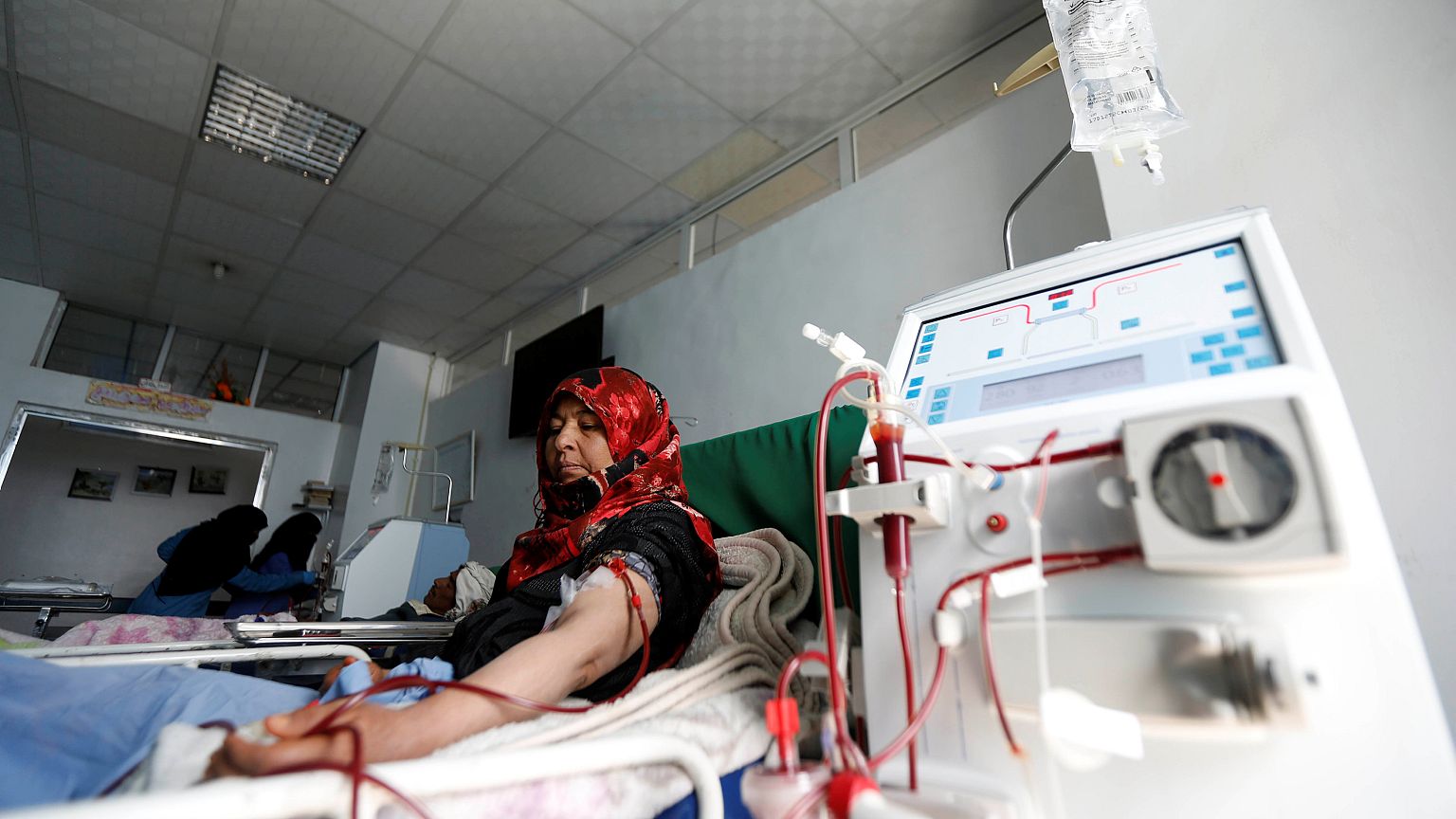 Először hoztak létre működő emberi veseszövetet élő szervezetben