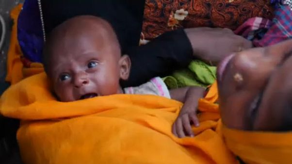 UNICEF küresel raporuna göre 16 milyon bebek ölüm riski altında UNICEF küresel raporuna göre 16 milyon bebek ölüm riski altında