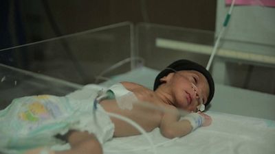 2,6 Millionen Babys sterben im ersten Lebensmonat