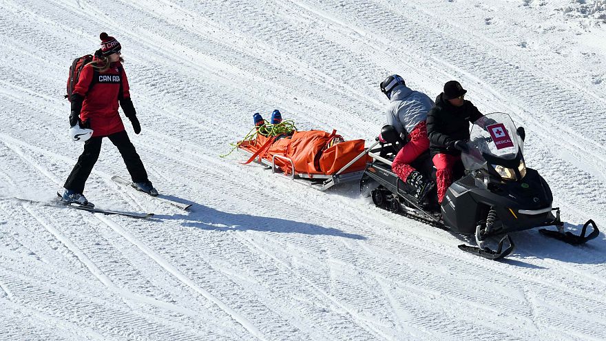 Káº¿t quáº£ hÃ¬nh áº£nh cho Broken bones from winter sports