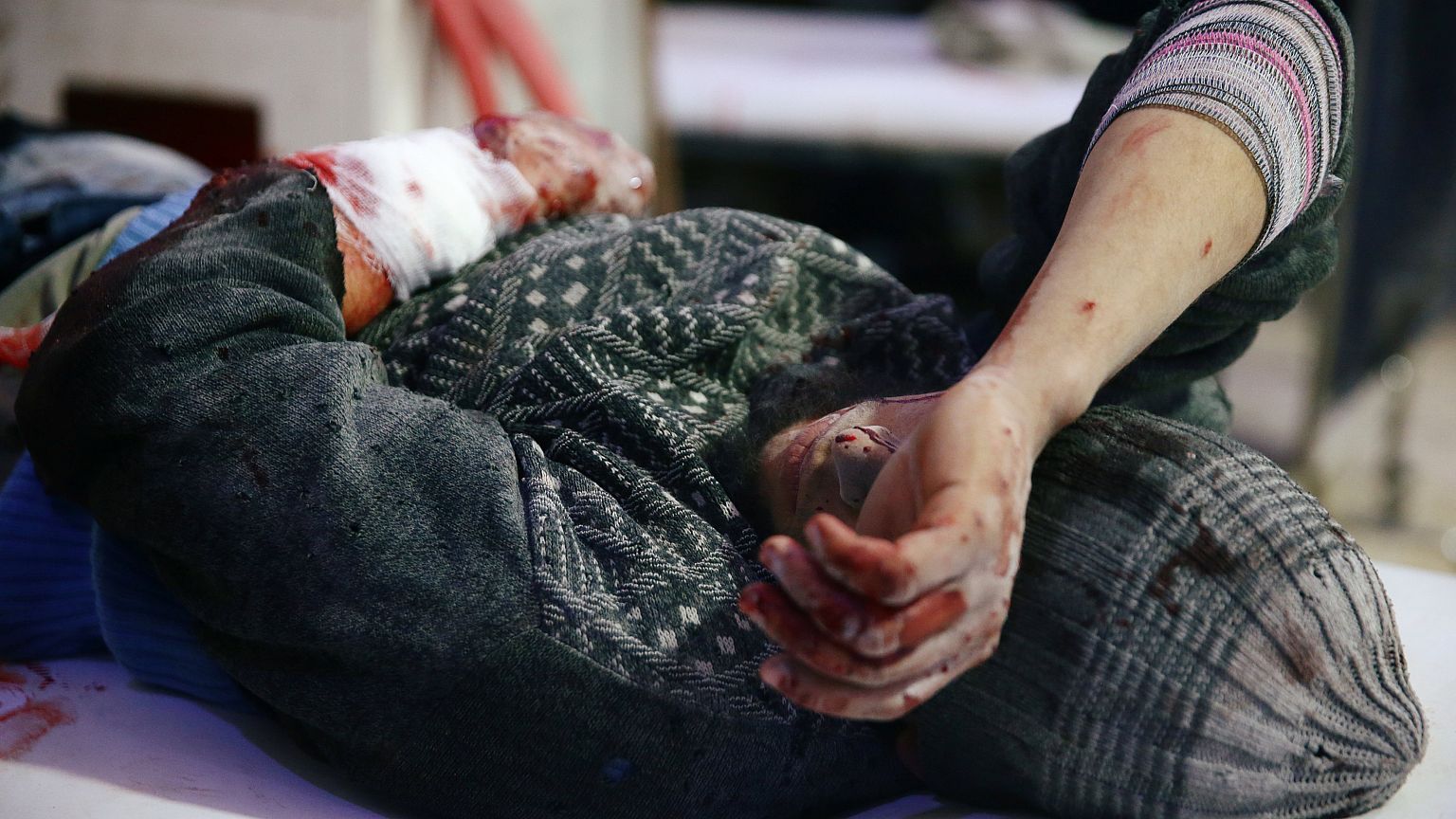 Ghouta sta morendo. La denuncia di Medici Senza Frontiere