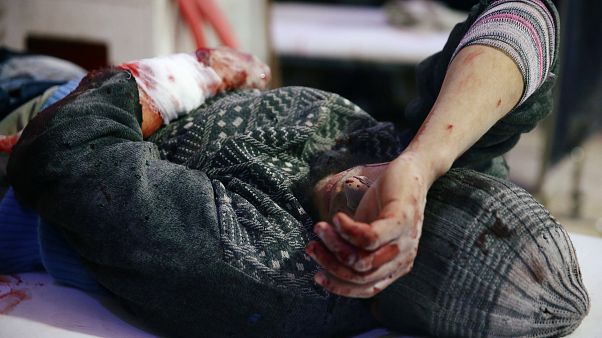 Ghouta sta morendo. La denuncia di Medici Senza Frontiere Ghouta sta morendo. La denuncia di Medici Senza Frontiere