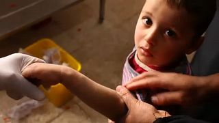 Csúnya bőrfekély-járvány Irakban
