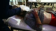 Toujours pas de trêve à la Ghouta et soupçons d'attaque chimique