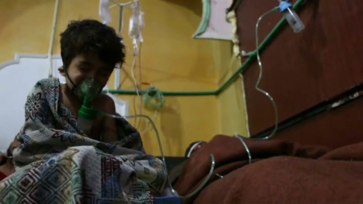 Child survivor of alleged poison gas attack in Ghouta