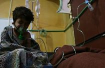 Child survivor of alleged poison gas attack in Ghouta