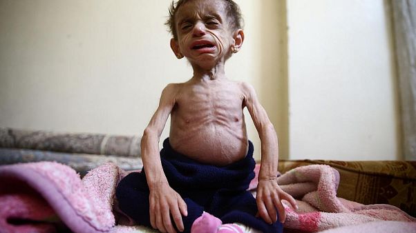 UNICEF: Suriye'de bu yıl en az bin çocuk öldürüldü UNICEF: Suriye'de bu yıl en az bin çocuk öldürüldü