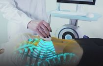 A tecnologia de ponta na luta contra a osteoporose