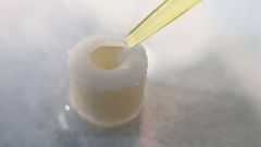 Nanopartikel gegen Arthrose