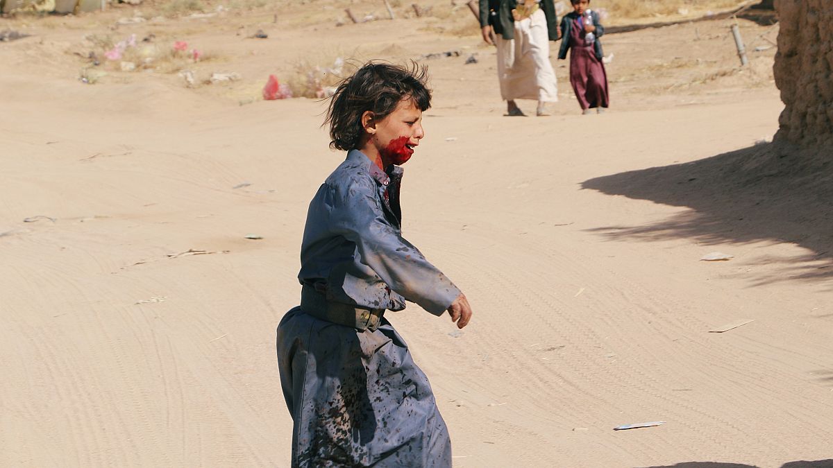 أطفال اليمن يعانون الأمرّين جراء الحرب الدائرة منذ أكثر من عامين