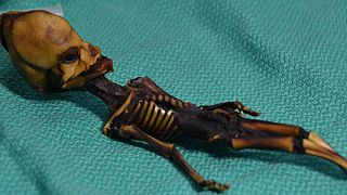 Mystery solved: alien-like skeleton found in Chile ‘was human’