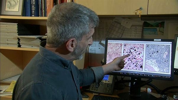 New organ could help understand spread of cancer New organ could help understand spread of cancer