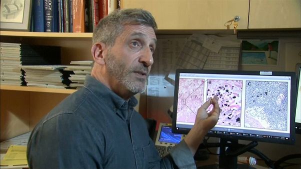 Intersticio: el nuevo órgano que puede ayudar a entender la propagación del cáncer Intersticio: el nuevo órgano que puede ayudar a entender la propagación del cáncer