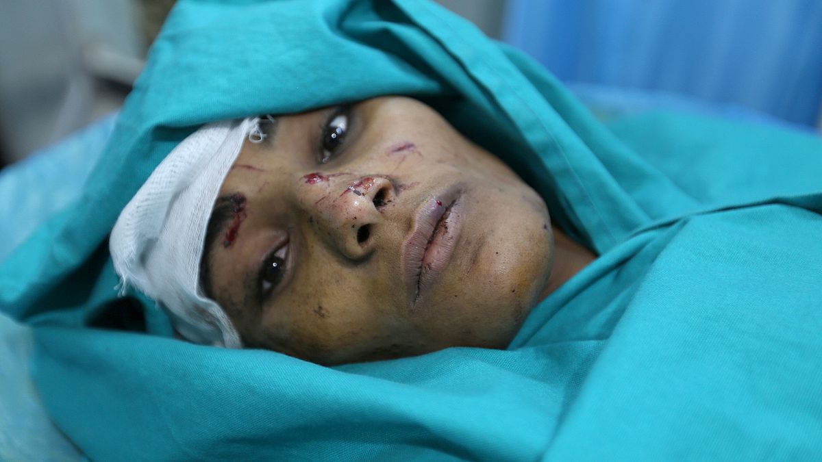 L'appel de l'ONU pour aider un Yémen à l'agonie  