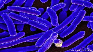 بكتيريا مقاومة للمضادات الحيوية تؤرق الأمريكيين
