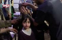 Girl looks on following alleged chemical weapons attack, said to be Douma 
