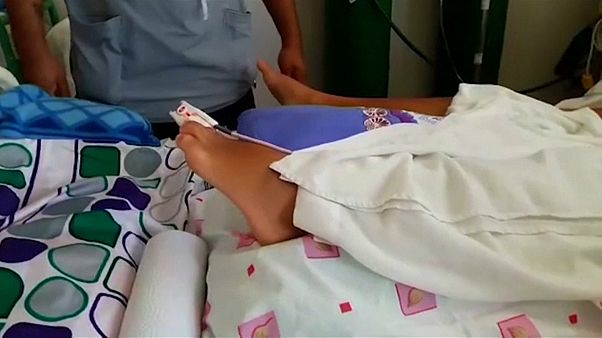 Perú descubre la posible causa del brote de Guillain-Barré Perú descubre la posible causa del brote de Guillain-Barré