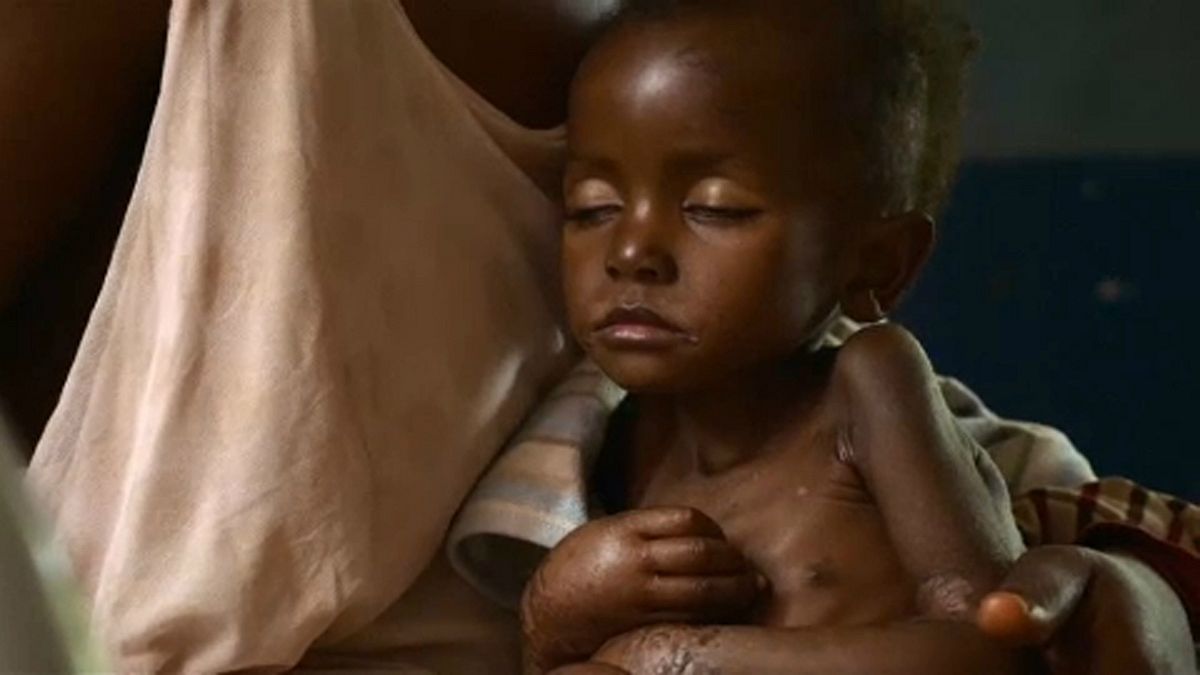 UNICEF: gyermekek az éhhalál küszöbén Kongóban
