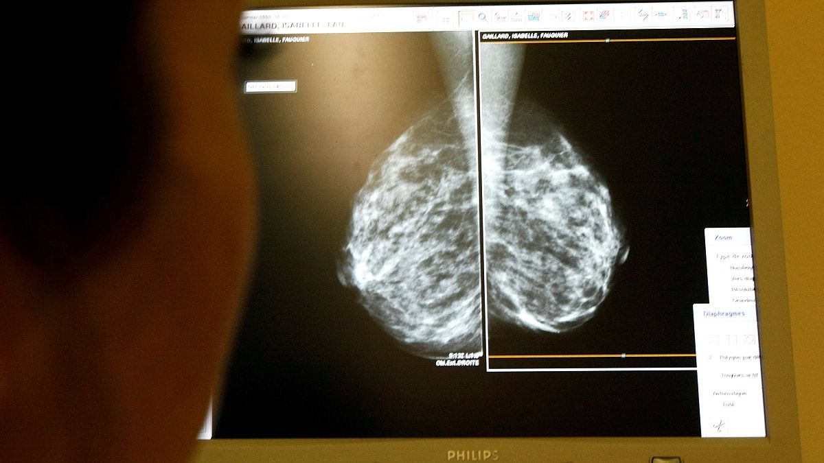 sreening mammography