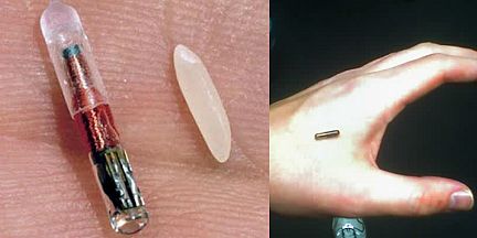 رقائق ألكترونية يتم زراعتها بين السبابة والإبهام - المصدر: ويكيميديا