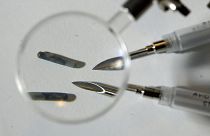 Between 2.000 and 3.500 people in Germany have Microchips implanted