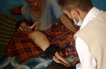 SOS για την Υεμένη από τις ανθρωπιστικές οργανώσεις