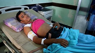 Sok civil sebesül meg Jemenben