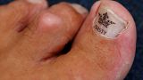 The toe of Alan "Nasty" Nash.
